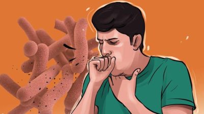 नवलपरासी पूर्वमा गण्डकी प्रदेशकै सबैभन्दा बढी क्षयरोगी